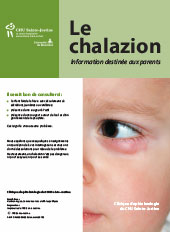 Chalazion enfant